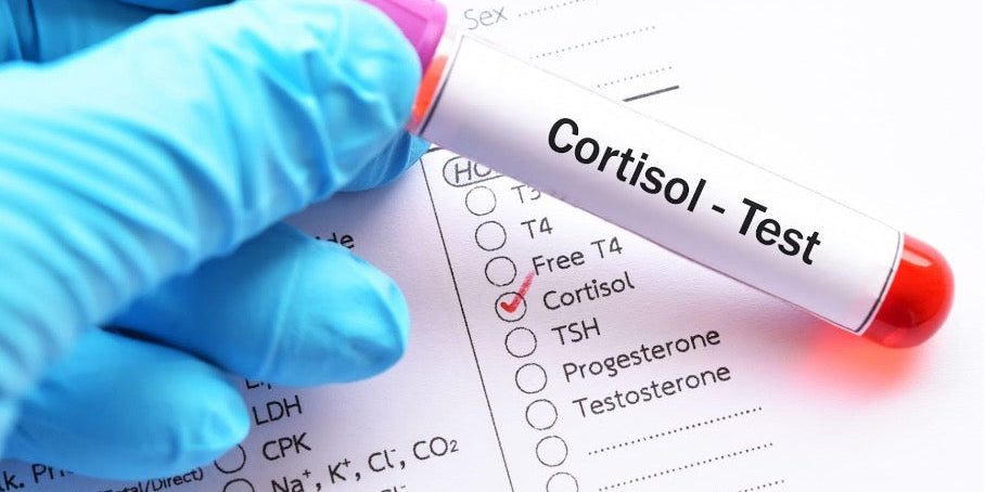 Cortisol Test